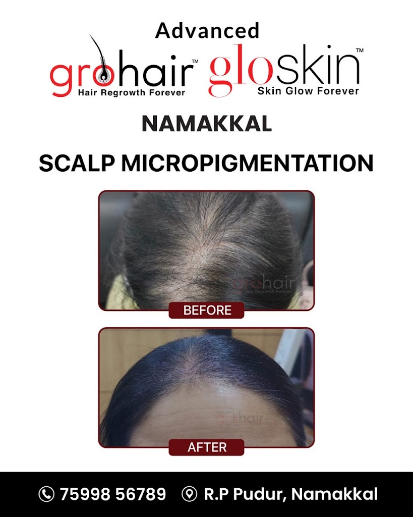 Advanced Grohair Gloskin Namakkal