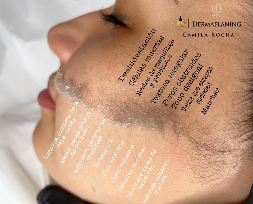 Thermal Beauty — Del propietario