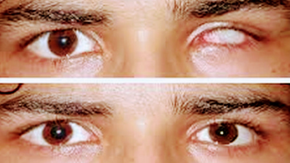 S S Vision Care