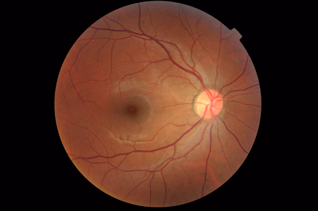 Dr Agarwal S Eye Hospital