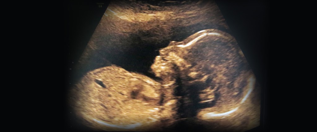 Dr. Dr. Chawla's Diagnostic Centre - CT Scan : Ultrasound : Lab: Fetal Medicine : OPG : X-Ray
