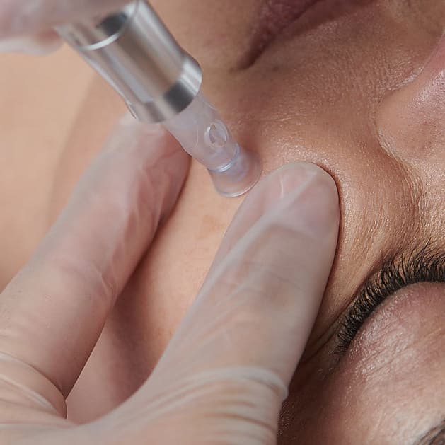 B&B Center Estetica avanzada (Mislata)