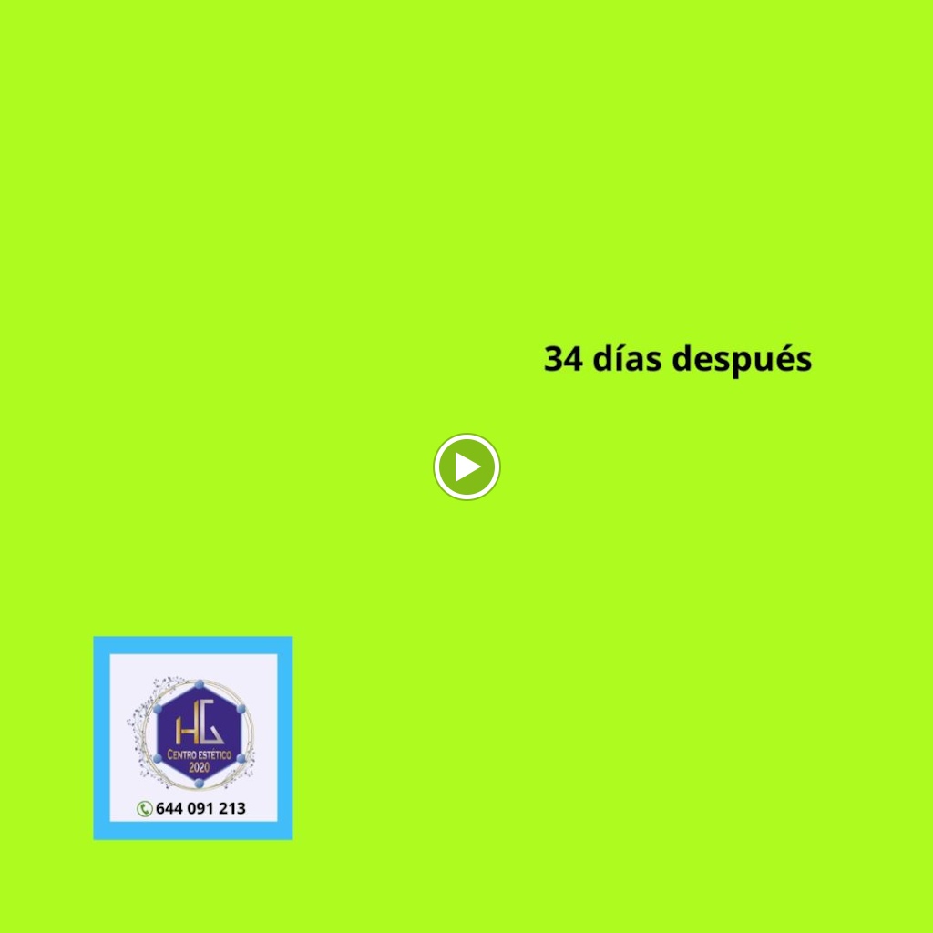 Centro Estetico 2020 — Videos