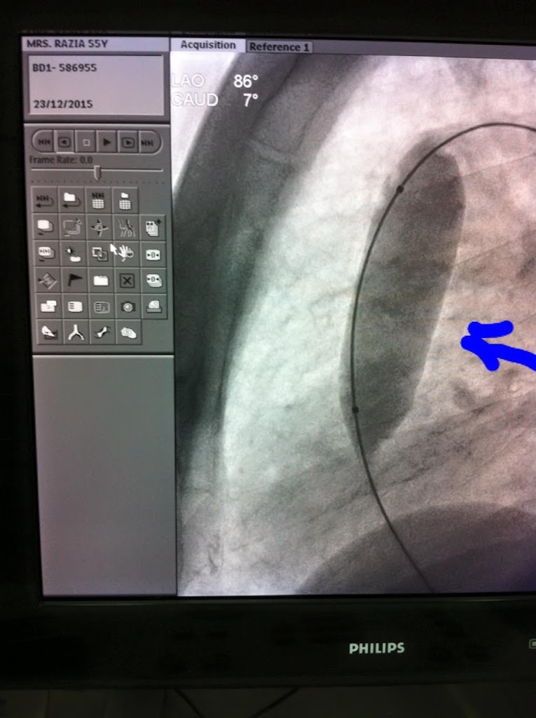 Dr. Prof Dr Aqm Reza Interventional Cardiologist Sr Consultant