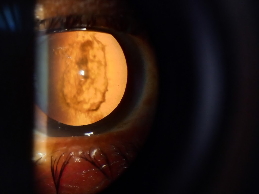 Rishabh Eye Care