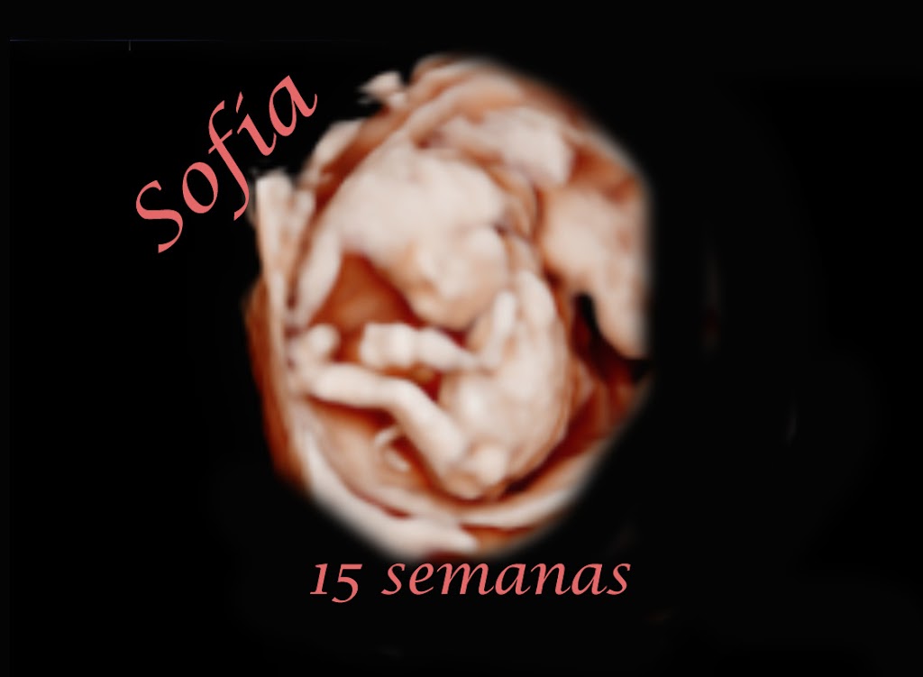 Gestos 5D - Centro de Ecografia 5D en Sevilla — Mas recientes
