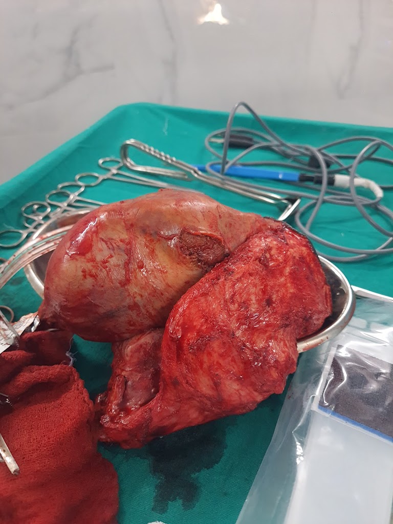 Dr. Best Vascular Surgeon Dr Arun Haridas