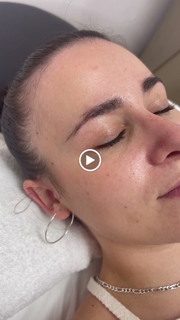 Vp Estetica — Videos