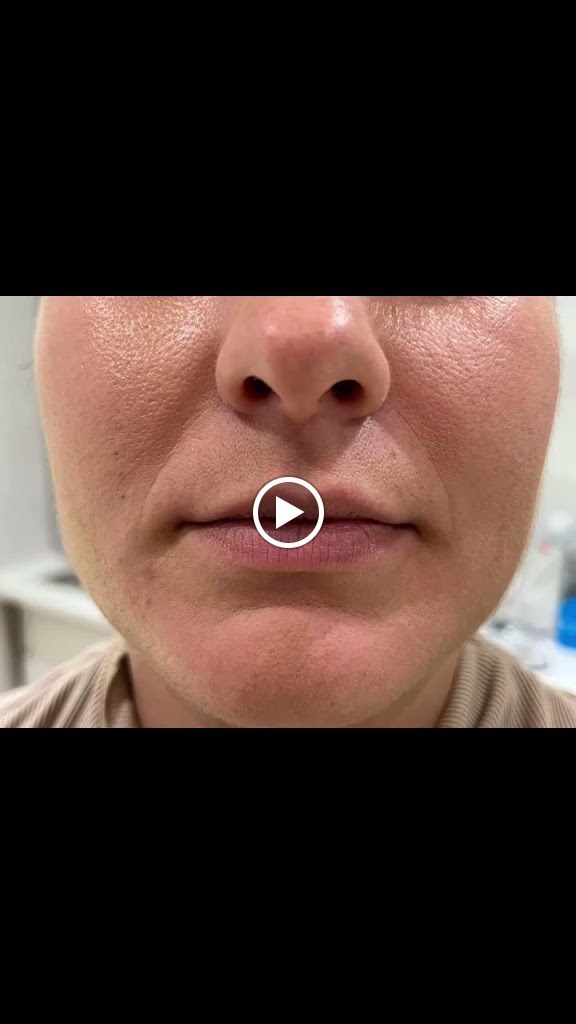 Rejuvelook - Clinica Estetica Fuengirola, Malaga — Videos