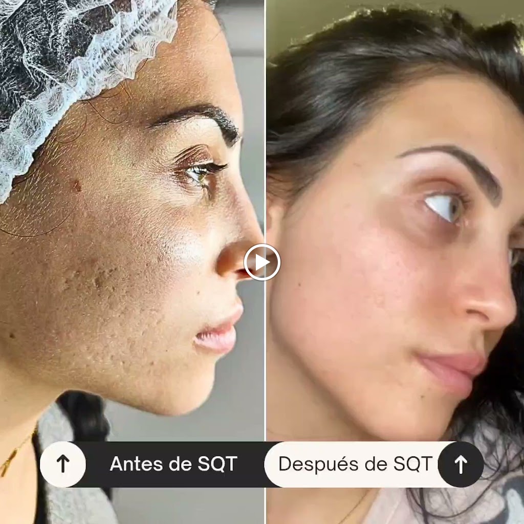 Centro de estetica tony moran — Videos