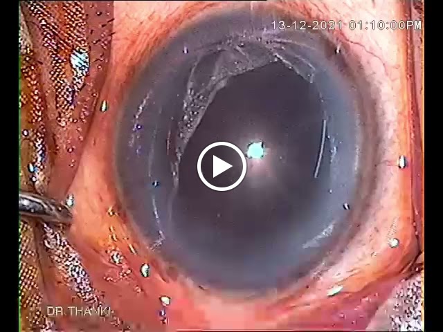 Dr Thanki Eye Hospital Veraval