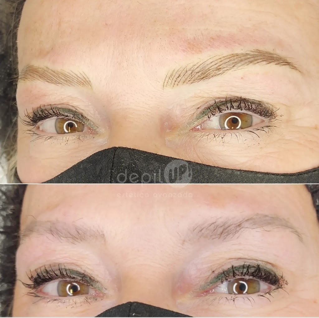 Depilup! estetica avanzada