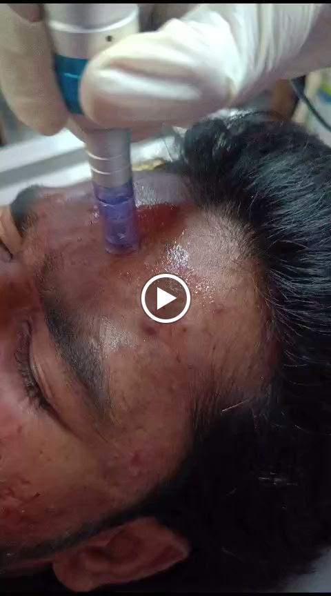 Cosmoderm Ayurved Cosmetologist Dermatologist Panchakarm Treatment Laser Treatment Best Ayurvedic Doctor In Jalgaon