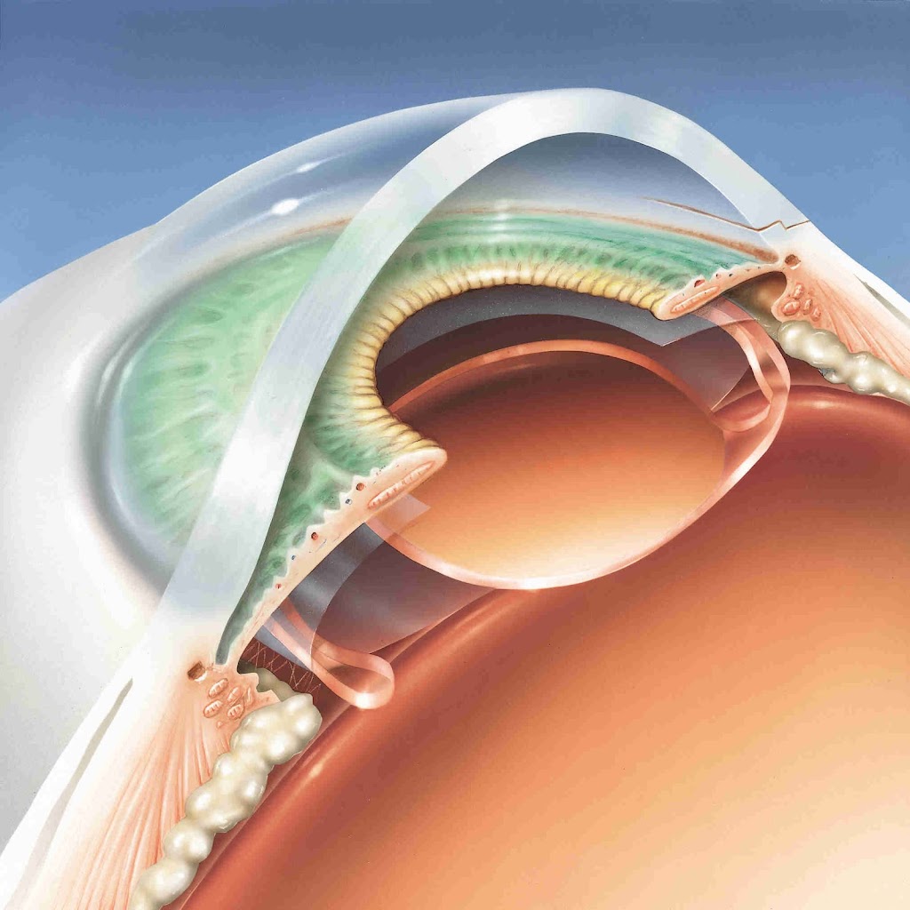 Bhargava Eye Centre
