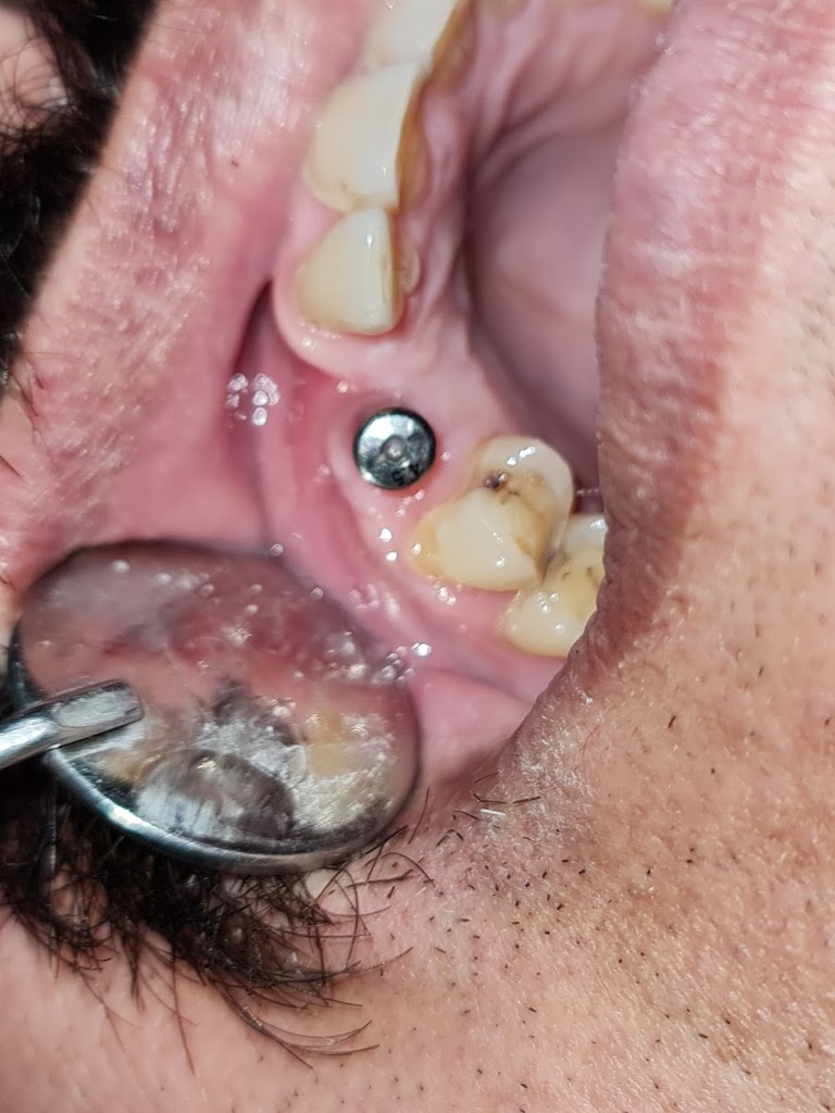 Tooth