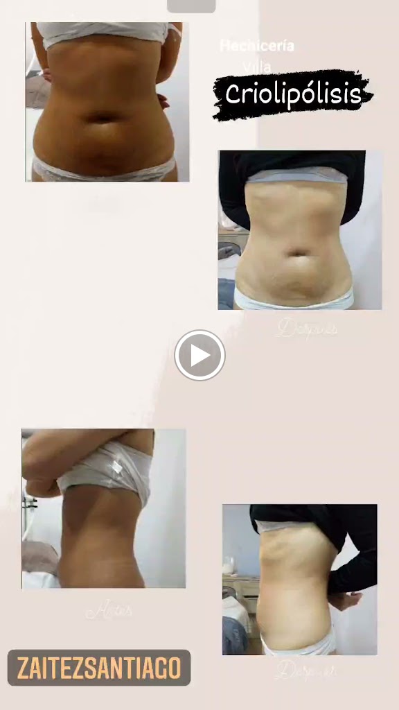 Zaitez Estetica Avanzada — Videos