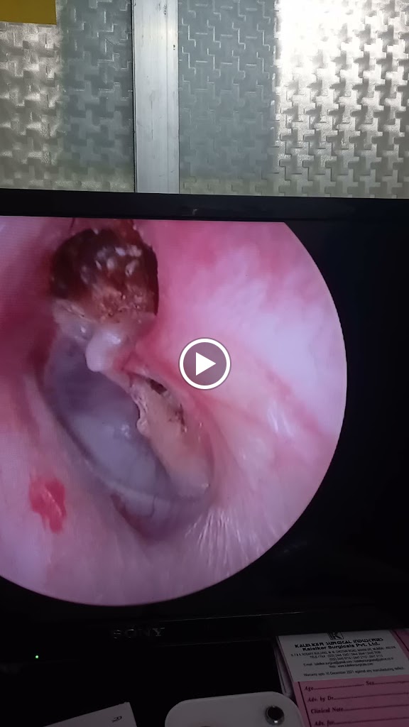Videos