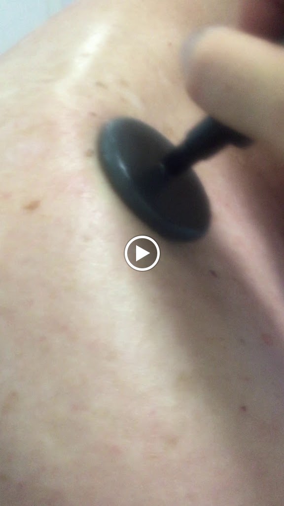 FiSant Fisioterapia Galapagar — Videos