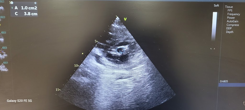 Dr. Dr Nilesh Tawade Adult And Paediatric Cardiologist