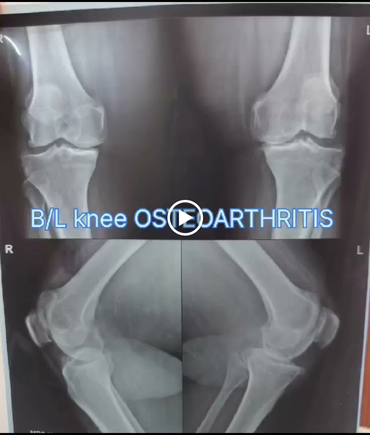 Aadhar Clinic Trauma Joint Replacement Infertility Laparoscopic Center