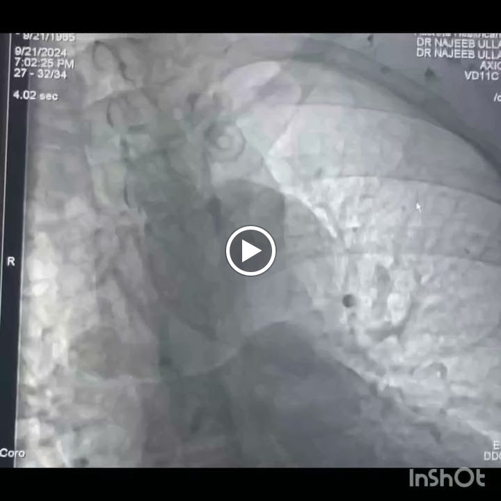 Videos