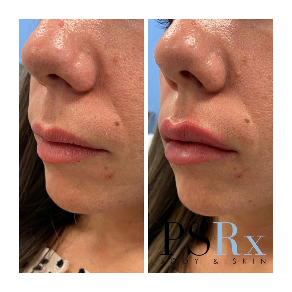 PSRx BODY & SKIN MED SPA ORLAND PARK - Orland Park, IL