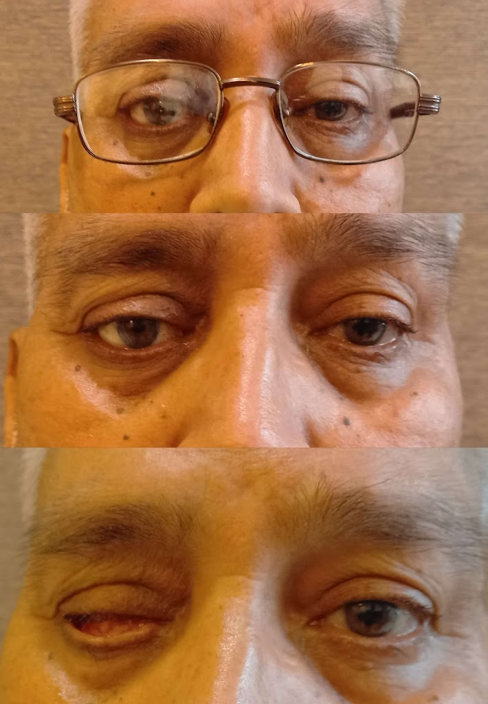Abhived Artificial Eye Center
