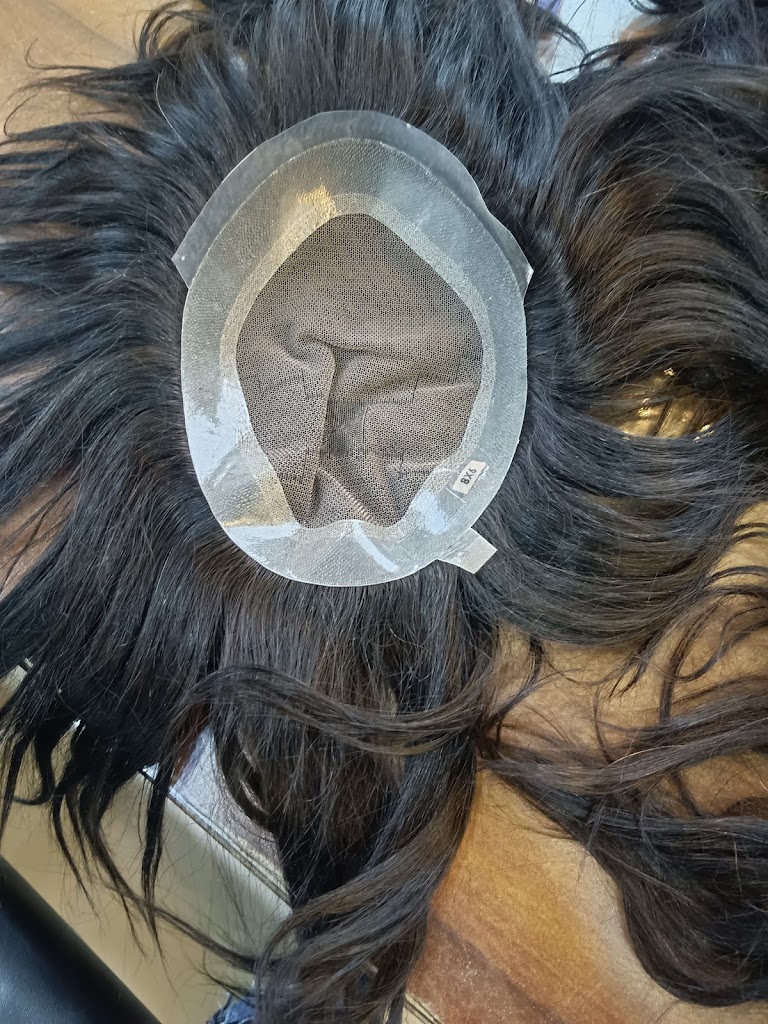 Arman Hair Solution Hair Patch Center