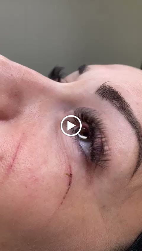 Guapix — Videos