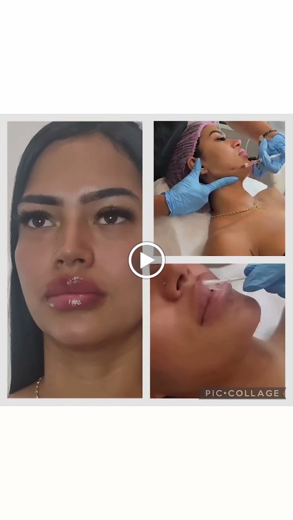 Pilar Rengifo Estetic Marbella — Videos