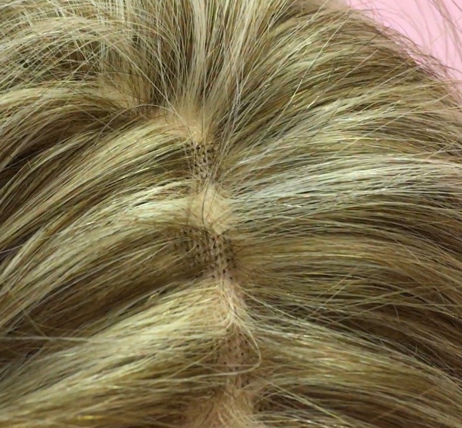 Edu Peluqueria Pelucas oncologicas TUPELUCA.COM (Punto venta autorizado)