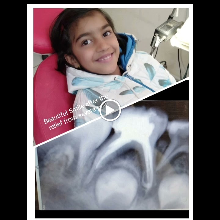 Videos