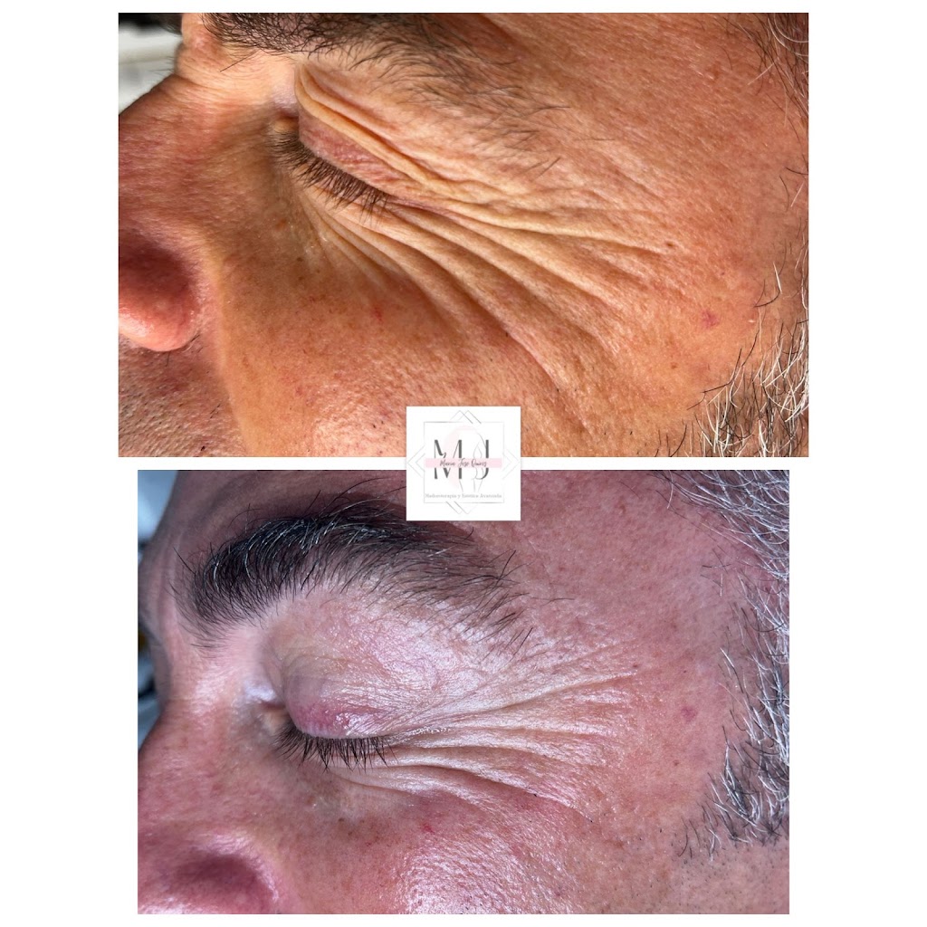 Centro Estetica MARIA JOSE QUIROS | Clinica Estetica Avanzada — Del propietario