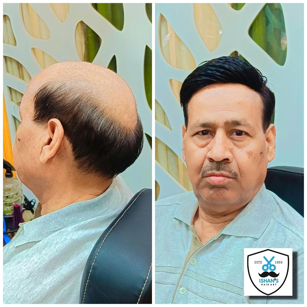 Ishan Hair Patch Wig Center Iishaan Heyr Vig Sainttr Etawah