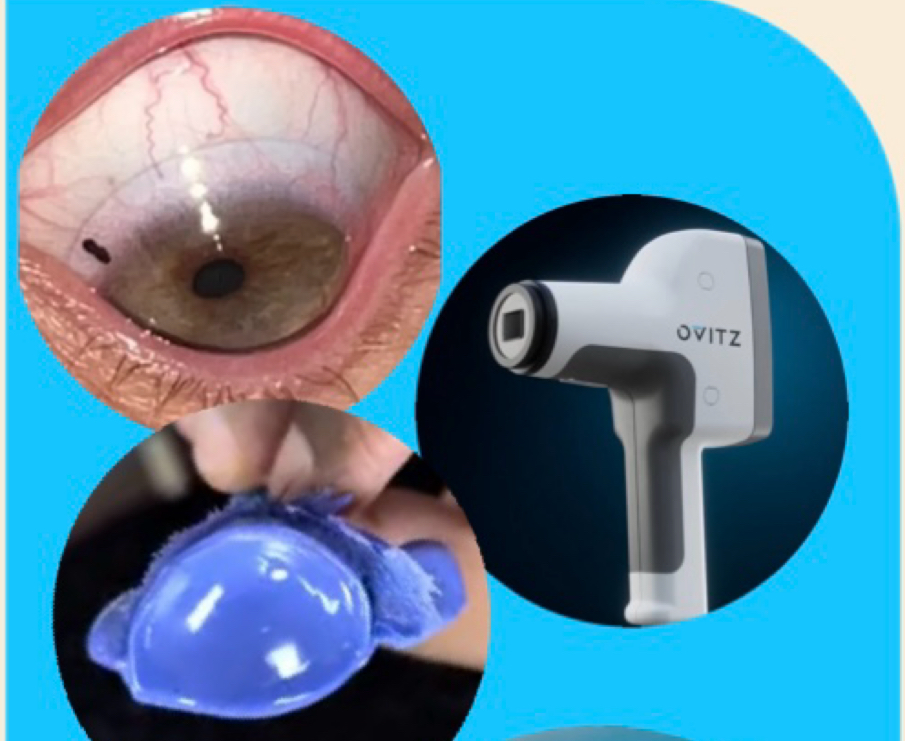 Shekhar Eye Research