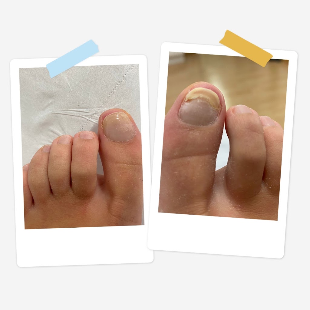 Podoloxia Santa Uxia