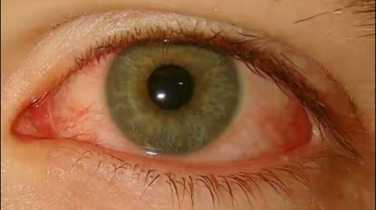 Nayan Eye Care Chashmaghar