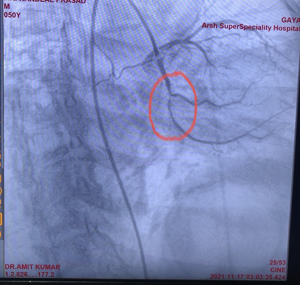 Dr. Dr Amit Kumar Md Dm Interventional Cardiologist