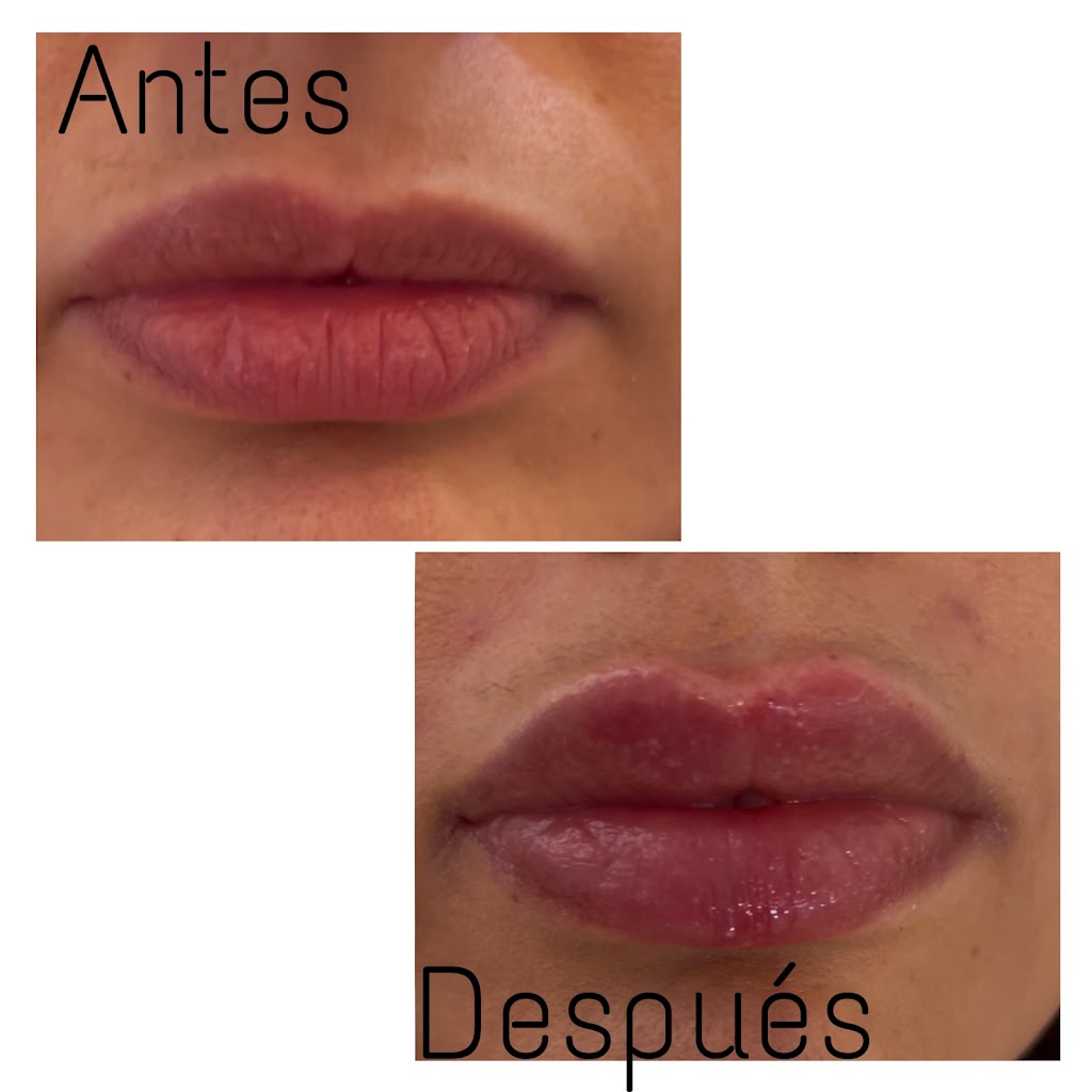Kirei estetica integral avanzada — Mas recientes