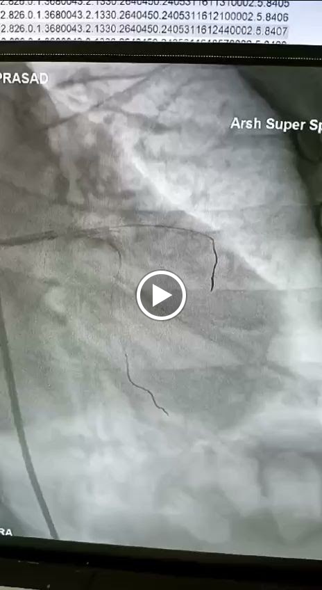 Dr. Dr Abu Huraira Mbbs Md Dm Cardiology