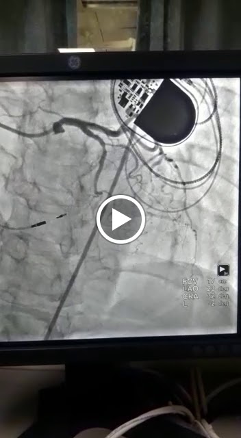 Dr. Dr Velu S Heart And Rhythm Clinic Dr Vadivelu