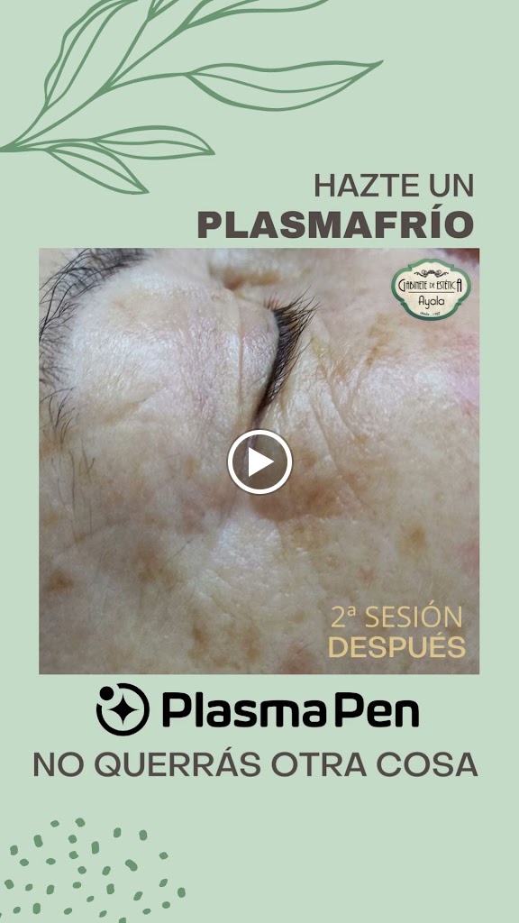 Gabinete de Estetica Ayala — Videos