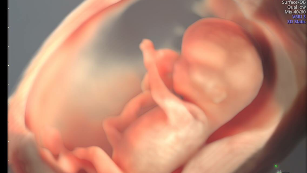 Dr. Jay Hospital Best Womens Health Hospitals Ivf Test Tube Baby Center Gynecologist In Porbandar Fetal Medicine Center