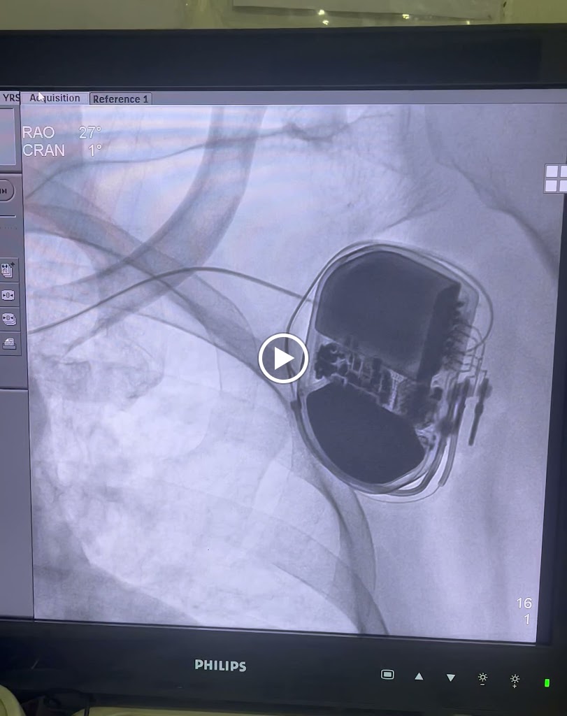 Dr. Dr Chetan Rathi Cardiologist Nagpur