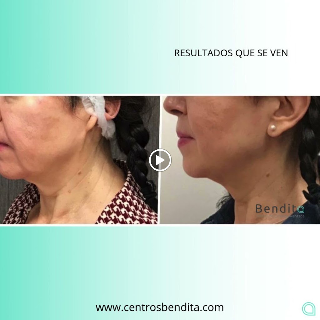 Centros Bendita Mislata