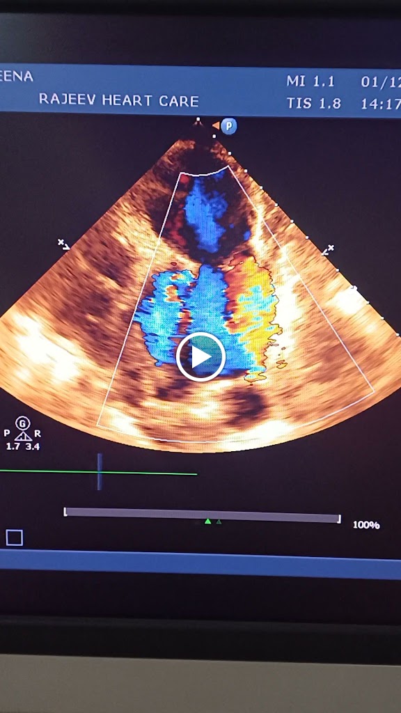 Dr. Rajeev Heart Care