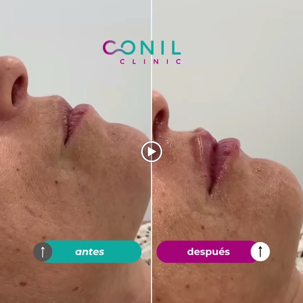 Medicina Estetica Conil Clinic — Videos