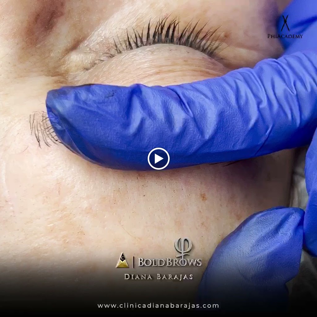 Microblading Las Palmas - Micropigmentacion Las Palmas - Diana Barajas Clinica Estetica — Videos