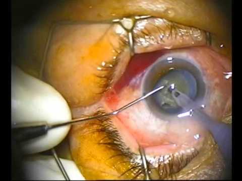 Samarth Eye Dental Clinic
