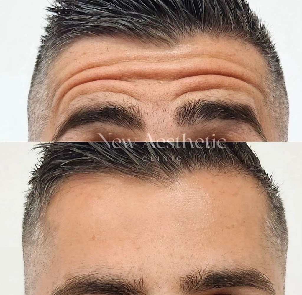 Clinic New Aesthetic | Medicina Estetica en Marbella